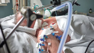 Фото: Мужчина после ночной драки впал в кому