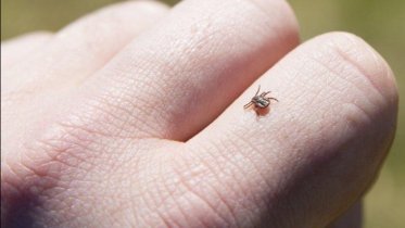 Фото: Пять человек уже стали «заложниками» клещей в Череповце