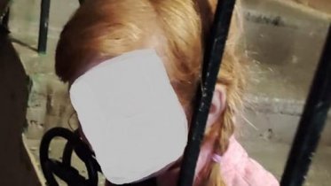 Фото: В Череповце девочка застряла между прутьев перил
