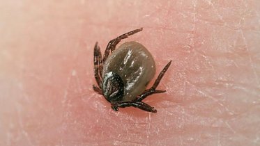 Фото: В Череповецком районе трех жителей  госпитализировали с клещевым боррелиозом