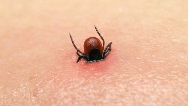 Фото: С подозрением на клещевой энцефалит госпитализировали двоих череповчан