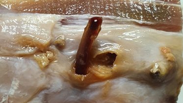 Фото: В блюде череповецкого ресторана обнаружили экзотического паразита