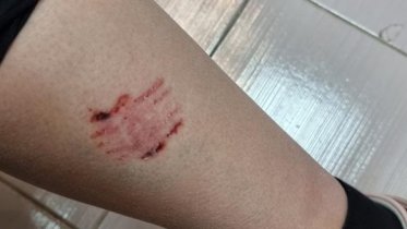 Фото: Возле усадьбы Гальских стая собак напала на череповчан