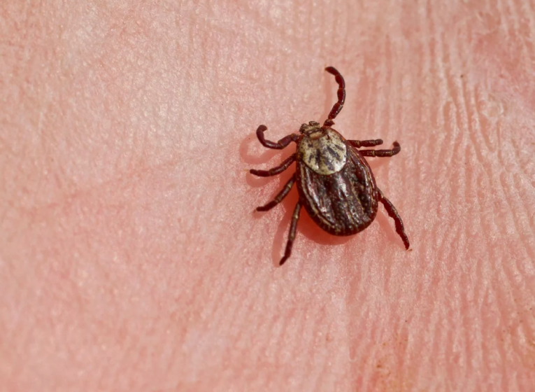 Фото: Число укусов клещей в Вологодской области превысило сотню с начала года