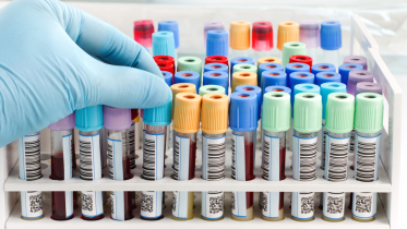 Фото: Бесплатная диагностика рака доступна жителям Вологодской области