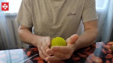 Фото: Череповецкие врачи помогли пациенту полностью восстановиться после инсульта