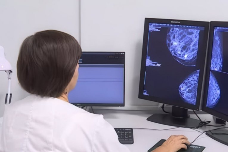 Фото: Референс-центры Вологодской области обработали 95 тысяч медицинских снимков