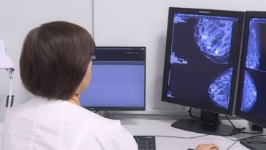 Фото: Референс-центры Вологодской области обработали 95 тысяч медицинских снимков